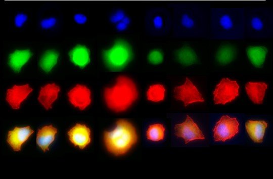 Typ-1-Diabetes-Forschung -Dan Stem