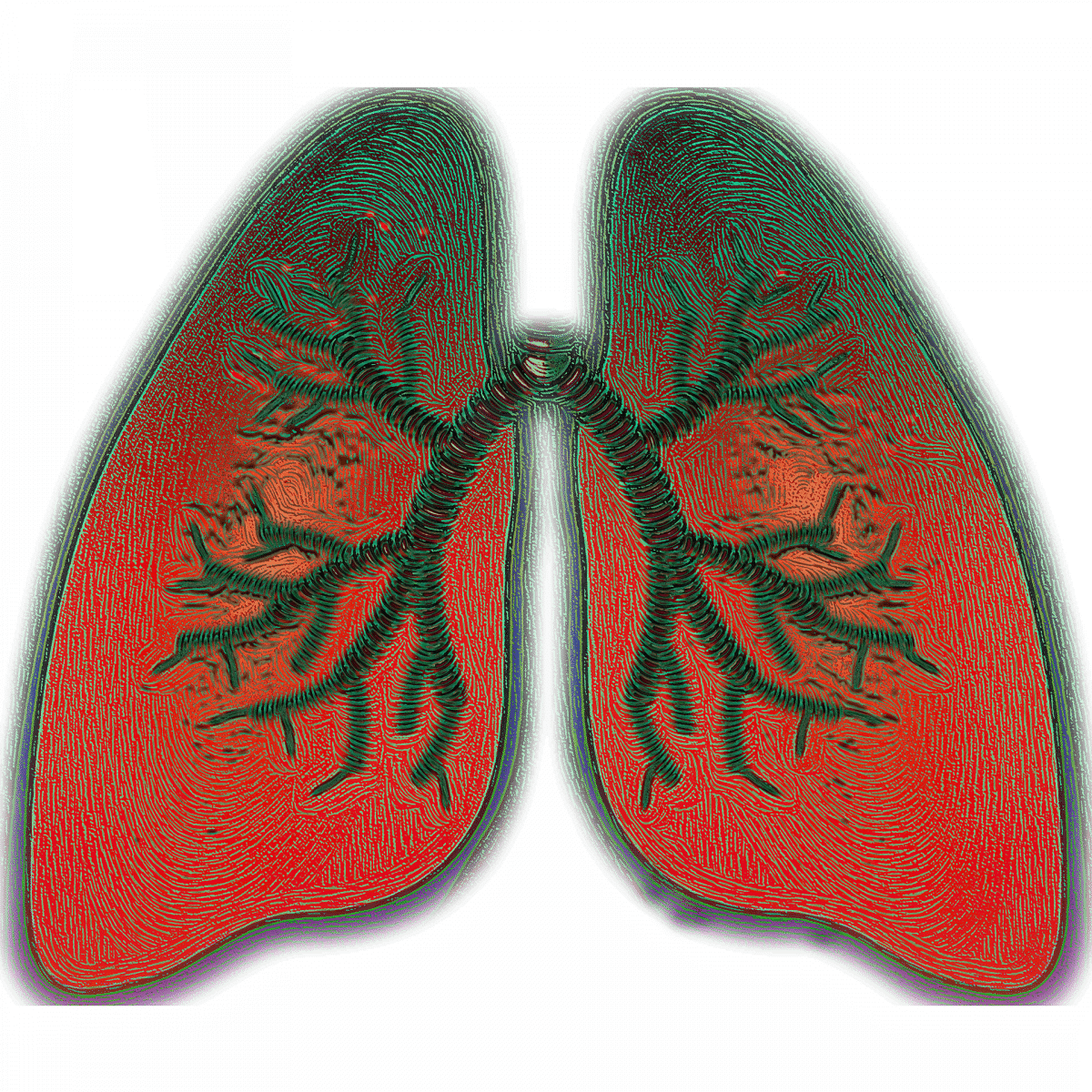 lung-4051083_1920 Asthma