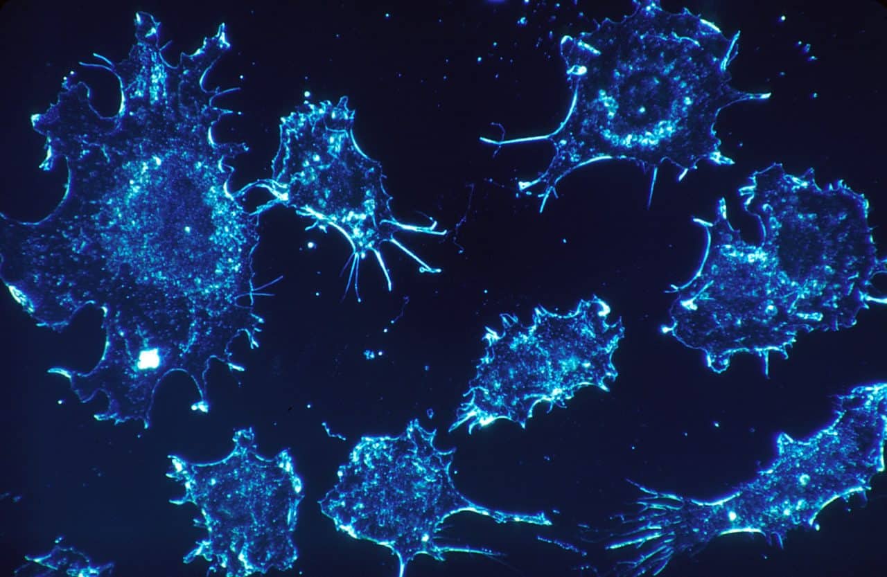 cancer-cells-541954_1920 cancer-cells-541954_1920