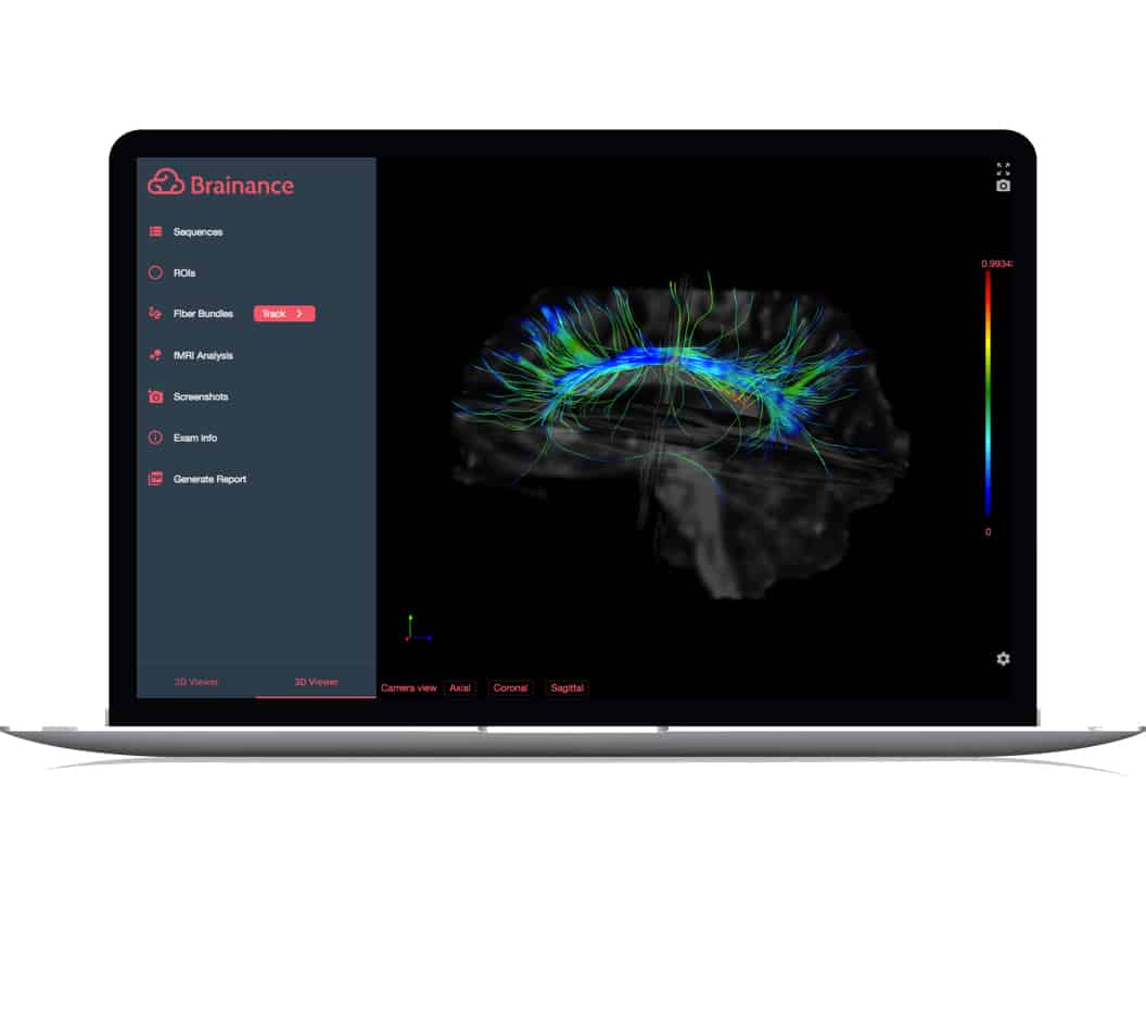Brainance MD Brainance MD