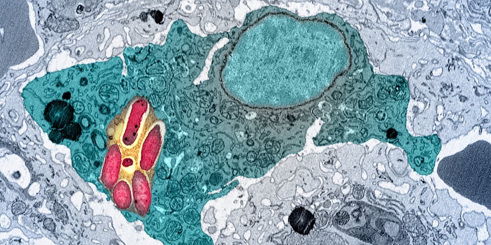 salmonella_in_macrophage_1000x500 salmonella_in_macrophage_1000x500