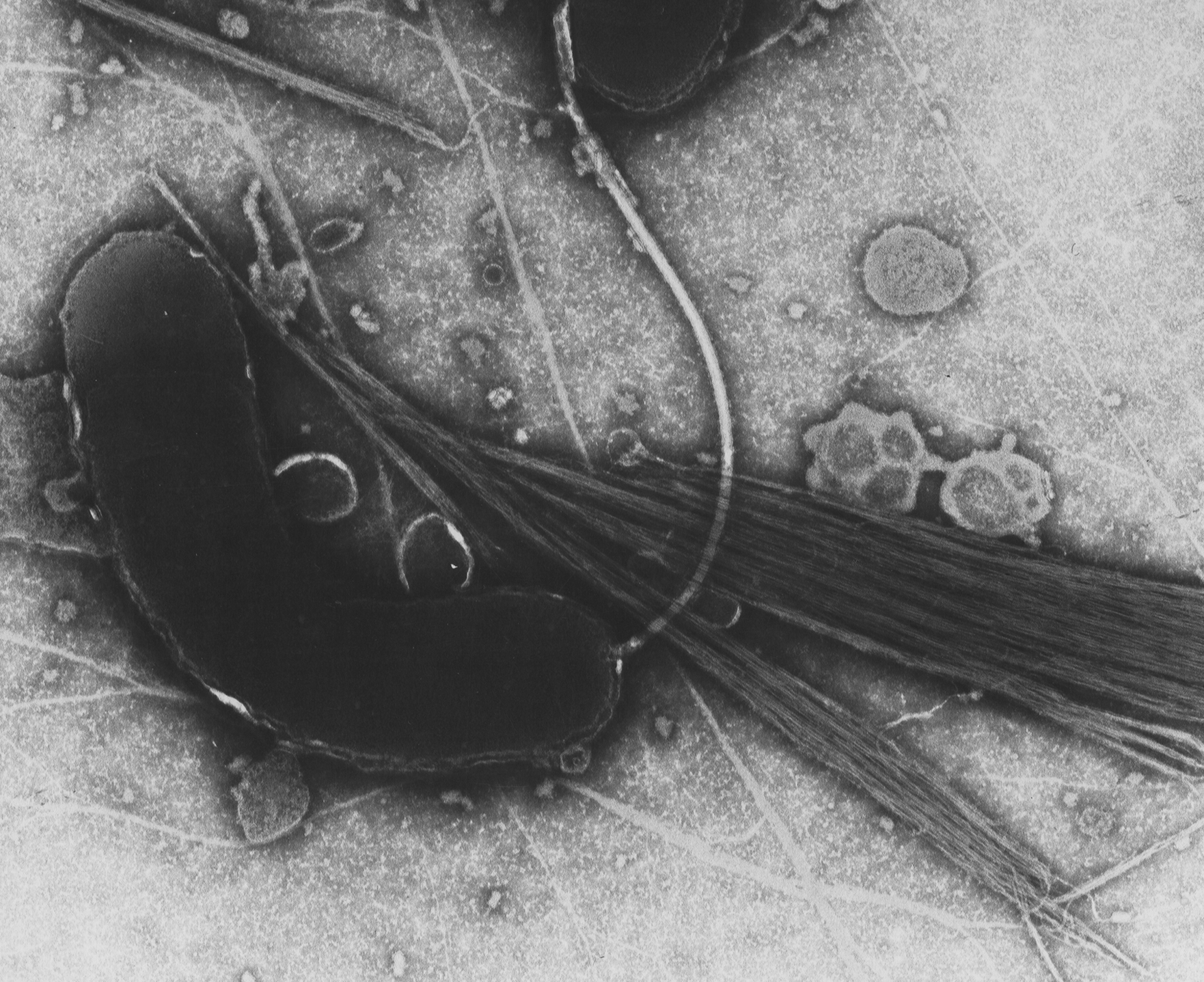 Cholera-Bakterium Vibrio Cholerae (c) commons wikimedia org: Von Tom Kirn, Ron Taylor, Louisa Howard - Dartmouth Electron Microscope Facility Cholera-Bakterium, Cholera