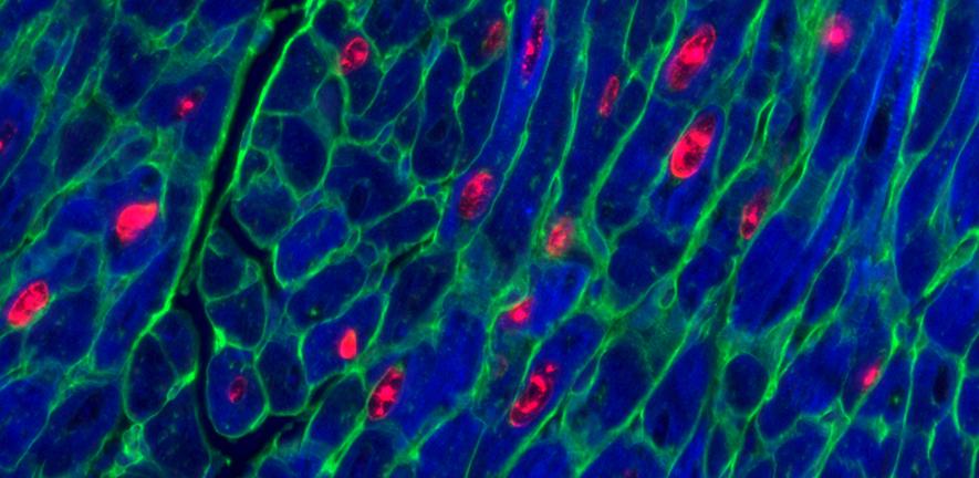 image3adultmouseheartmusclecellscropjpeg image3adultmouseheartmusclecellscropjpeg