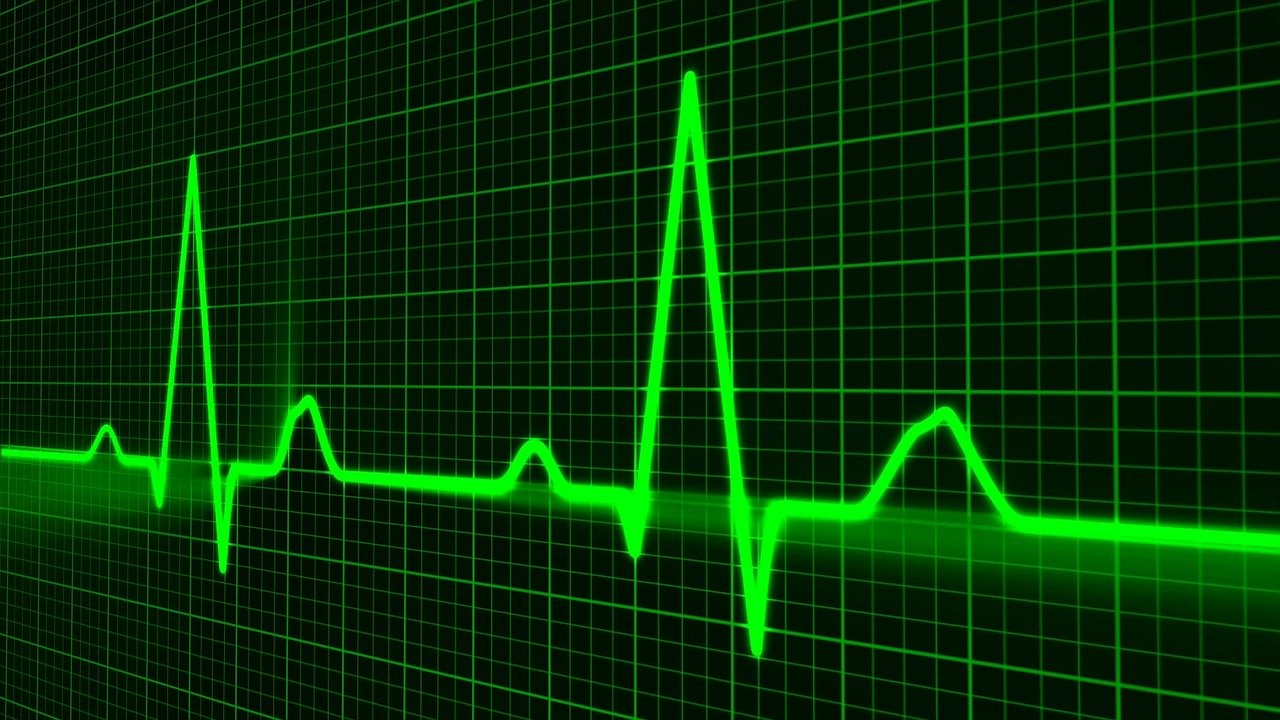 pulse-trace-163708_1280 pulse-trace-163708_1280
