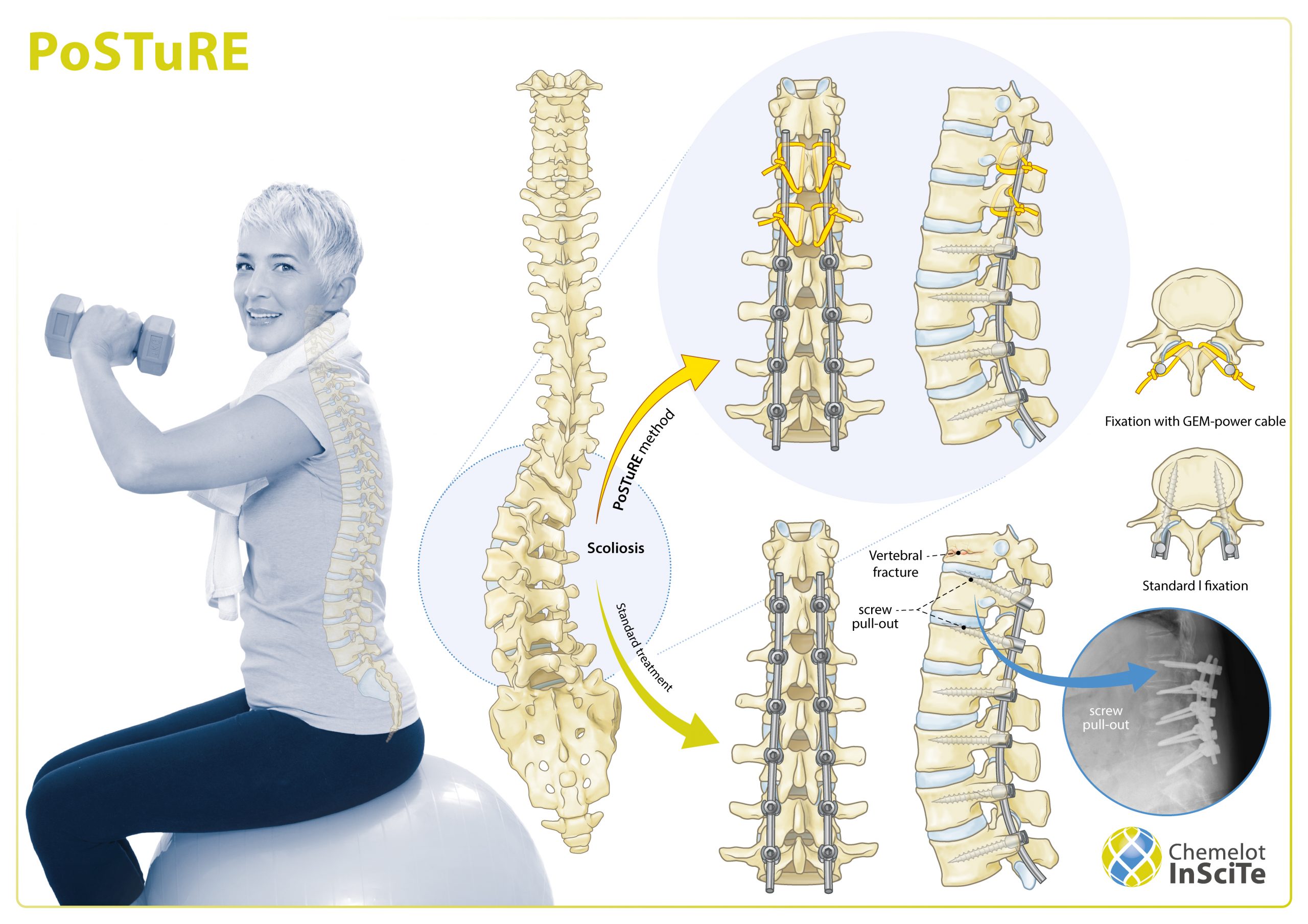 PoSTuRE-ENG PoSTuRE-ENG