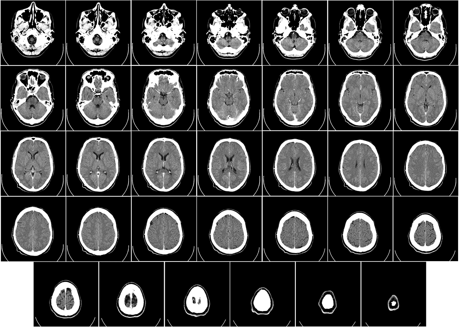 computer-tomography-62942_1920