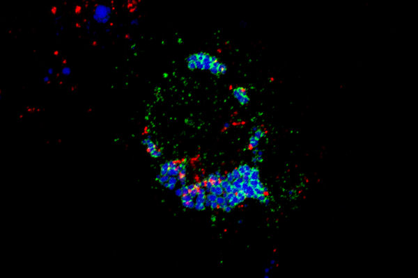 EnrichC_LuA_fotoGRUP_B Confocal microscopy image showing SNX13 protein (green) in regions of the endoplasmic reticulum contacting lipid droplets (blue) and lysosomes in which the BMP lipid is present (red).