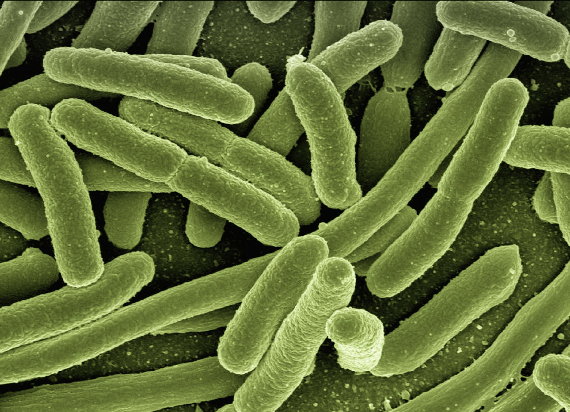 koli-bacteria-gaedd77e31_1920 bacteria