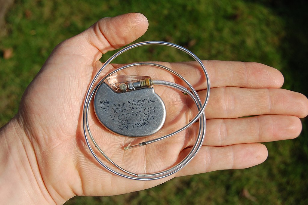 St_Jude_Medical_pacemaker_in_hand Pacemaker with electrode