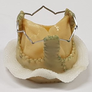 ikts-preventing-calcification-of-bioprosthetic-heart-valves-pic-1 ikts-preventing-calcification-of-bioprosthetic-heart-valves-pic-1