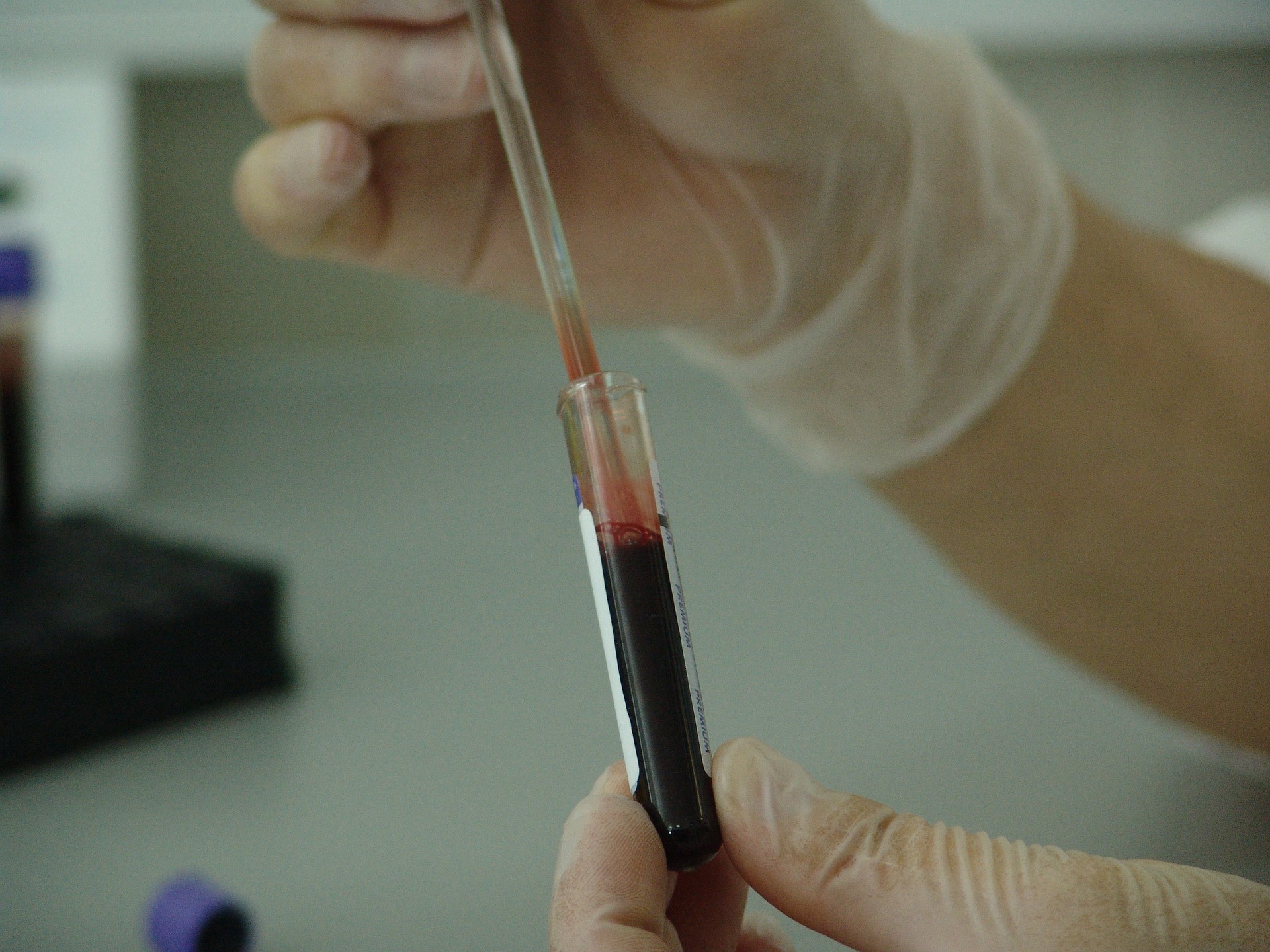 blood-g3f13512d4_1920 blood test